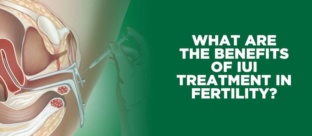 Benefits of IUI treatment in fertility