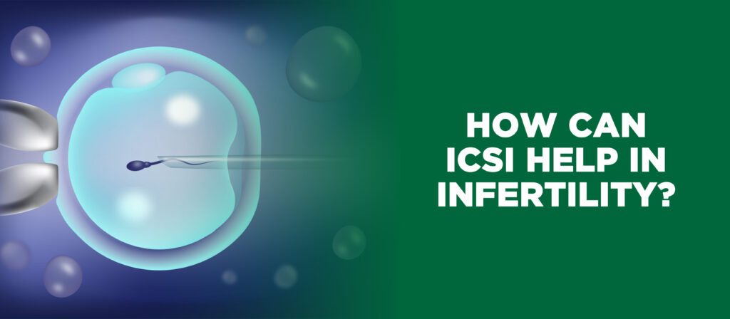 ICSI treatment for infertility
